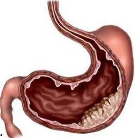 胃炎可以吃蓝瓜 第3张 胃炎可以吃蓝瓜 第3张